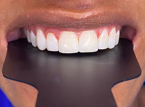 Slider image (5) Dra. Faneris Urrutia